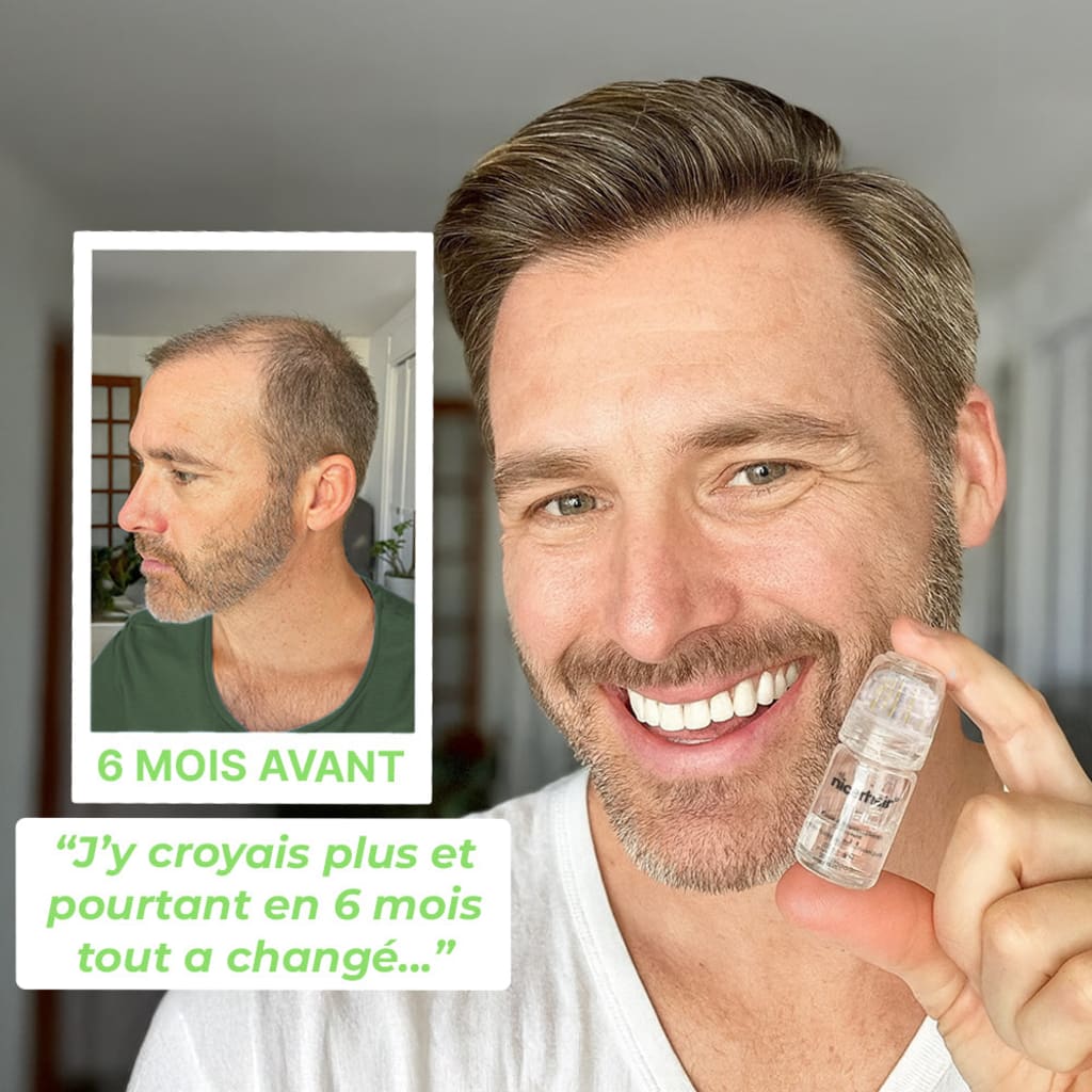 Kit Renouvellement Capillaire (FR)